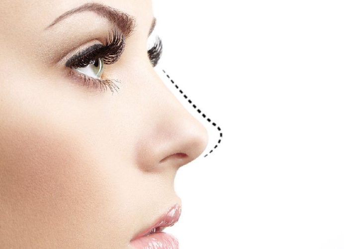 بهترین جراح بینی