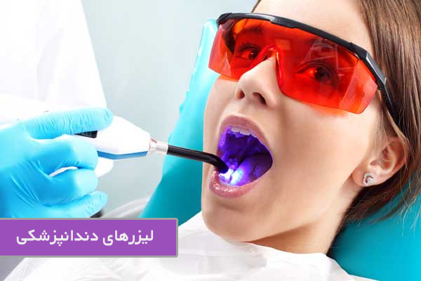لیزرهای دندانپزشکی
