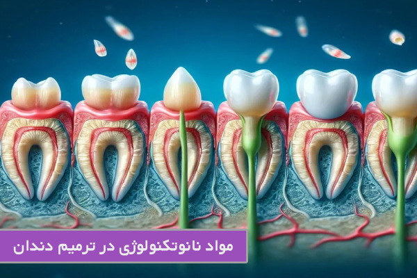 مواد نانوتکنولوژی در ترمیم دندان